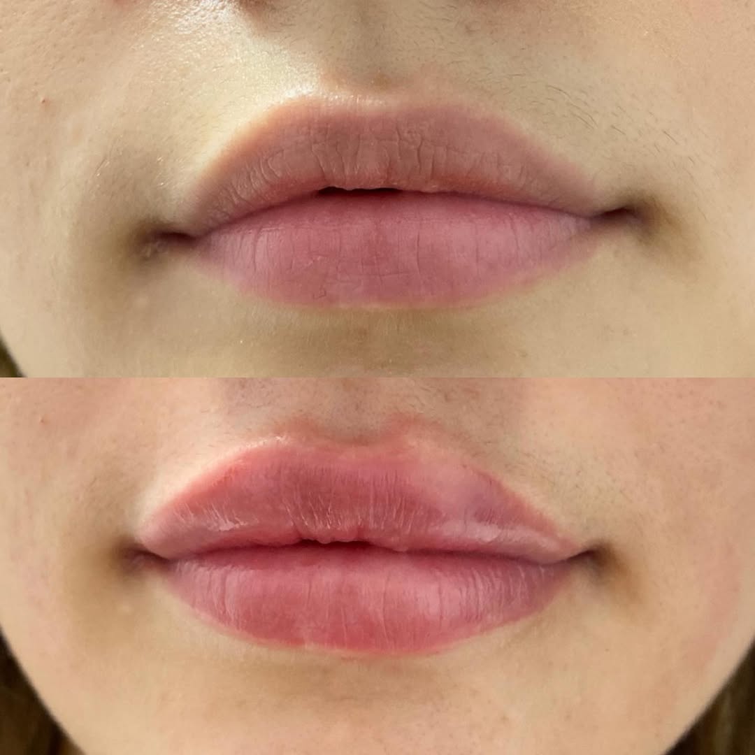 Micropigmentación Labios Acuarela